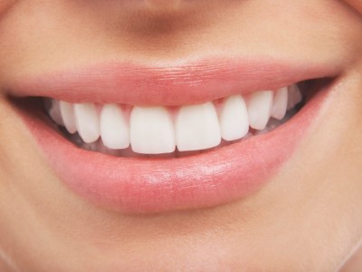 پرکردن دندان چیست؟